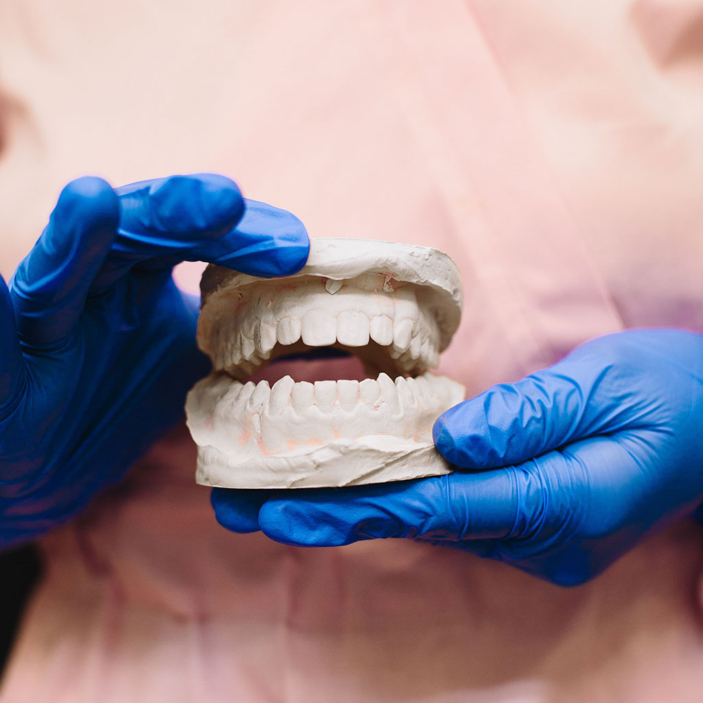 DentKraft Smile Gallery